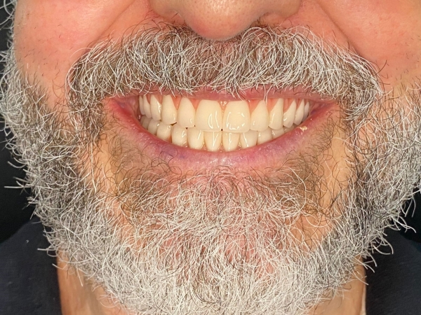 aparecido-depois.jpg